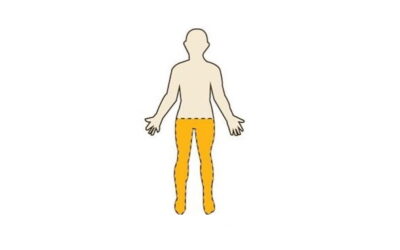 Spastic Diplegia: When Both Legs Are Affected