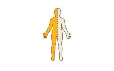 Spastic Hemiplegia: When Only One Side of the Body Is Affected