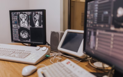 What Is a Brain MRI and What Does It Show in Cerebral Palsy?
