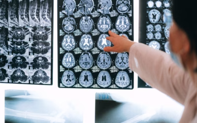 Cerebral Palsy vs. Other Neurological Conditions: How to Tell Them Apart
