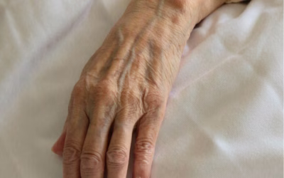 Premature Aging in Cerebral Palsy: Why the Body Declines Earlier